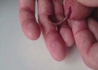 Dude puts a worm in his cock for some reason